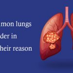 Most common lungs disorder in men and their reason